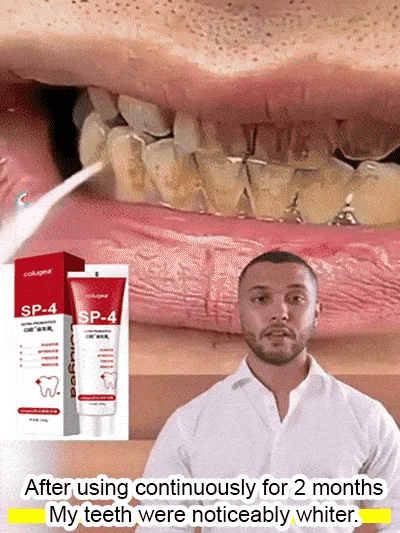 SP 4 Intensive Teeth Whitening Toothpaste ( BUY 1 GET 1 FREE ) ⭐️⭐️⭐️⭐️ 4.9/5 Reviews