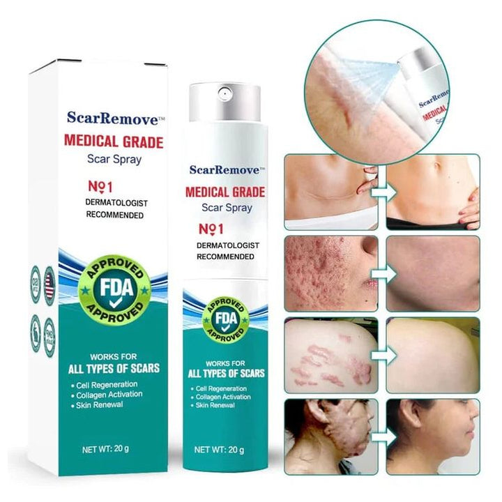ScarRemove™ All Type Scar Removal Spray - Korean Made | BUY 1 GET 1 FREE |  ⭐️⭐️⭐️⭐️ 4.9/5 Reviews