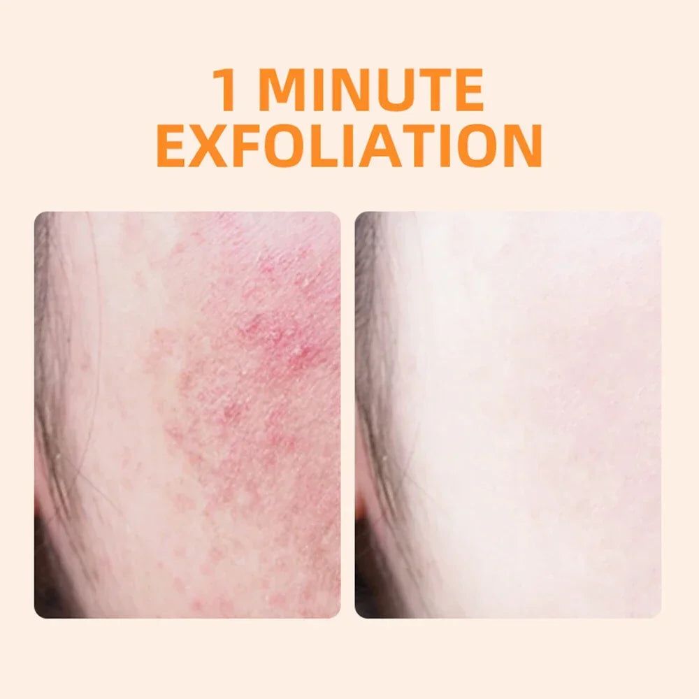 GMEELAN ORANGE EXFOLIATING GEL AND LAZY CREAM ( IMPORTED FROM SOUTH KOREA kr ) | BUY 1 GET 1 FREE | ⭐️⭐️⭐️⭐️ 4.9/5 Reviews