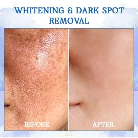 Fubsta™ Advanced Skin Tightening Rejuvenating Cream  ( BUY 1 GET 1 FREE )⭐️⭐️⭐️⭐️ 4.9/5 Reviews