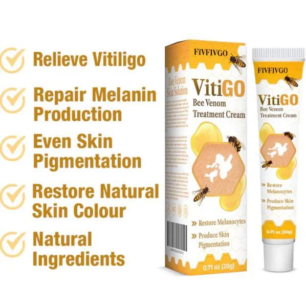 Fivfivgo™ BeeVenom Vitiligo ( 7 Days Result ) Treatment Cream- BUY 1 GET 1 FREE ⭐️⭐️⭐️⭐️ 4.9/5 Reviews