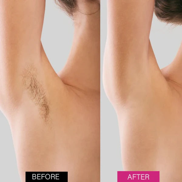 Fivfivgo™ BeeSilk Hair Removal Mousse-BUY 1 GET 1 FREE ⭐️⭐️⭐️⭐️ 4.9/5 Reviews