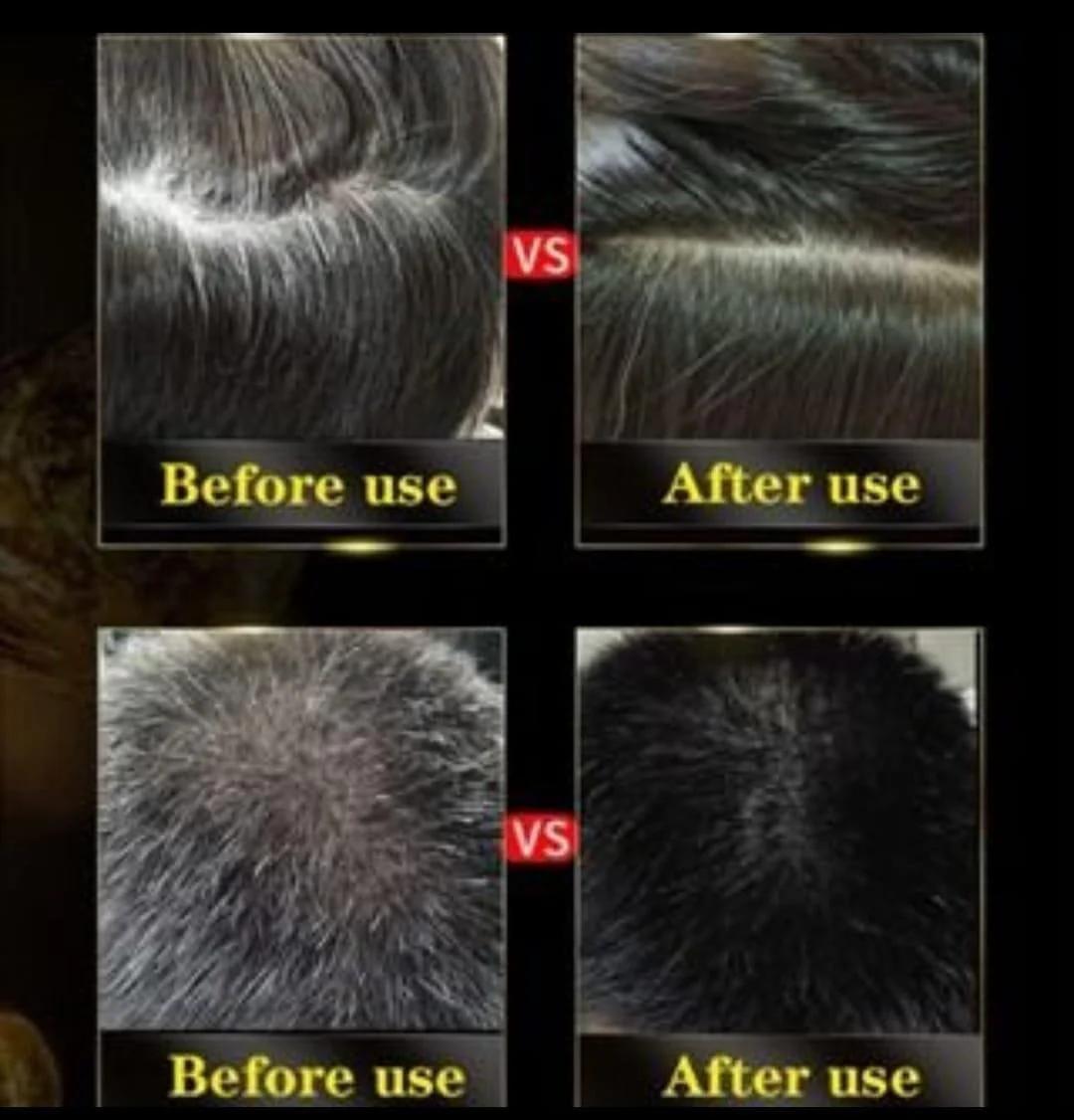 ✨The New-Black Hair Dye Shampoo Instant 3 in 1-100% Black Coverage (Buy 1 Get 1 Free😍)
