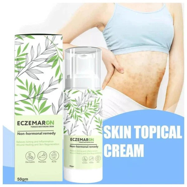 Eczemaron Anti Fungal Cream 50gm | Buy 1 Get 1 Free | ⭐️⭐️⭐️⭐️ 4.9/5 Reviews