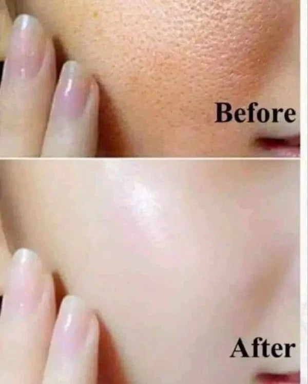 OSUFI Anti-Wrinkle Skin Serum | BUY 1 GET 1 FREE | ⭐️⭐️⭐️⭐️ 4.9/5 Reviews