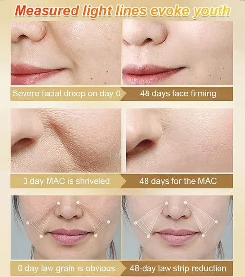 🔥Last Day 49% OFF- Anti-wrinkle firming serum 50ml