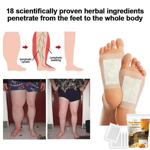 Bee Venom Lymphatic Drainage & Slimming Foot Patches 🌿👣10 Foot Patches!| BUY 1 GET 1 FREE | ⭐️⭐️⭐️⭐️ 4.9/5 Reviews