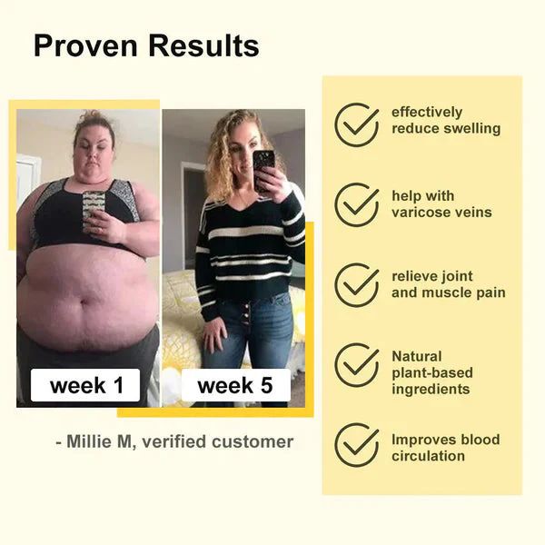 Bee Venom Lymphatic Drainage & Slimming Foot Patches 🌿👣10 Foot Patches!| BUY 1 GET 1 FREE | ⭐️⭐️⭐️⭐️ 4.9/5 Reviews