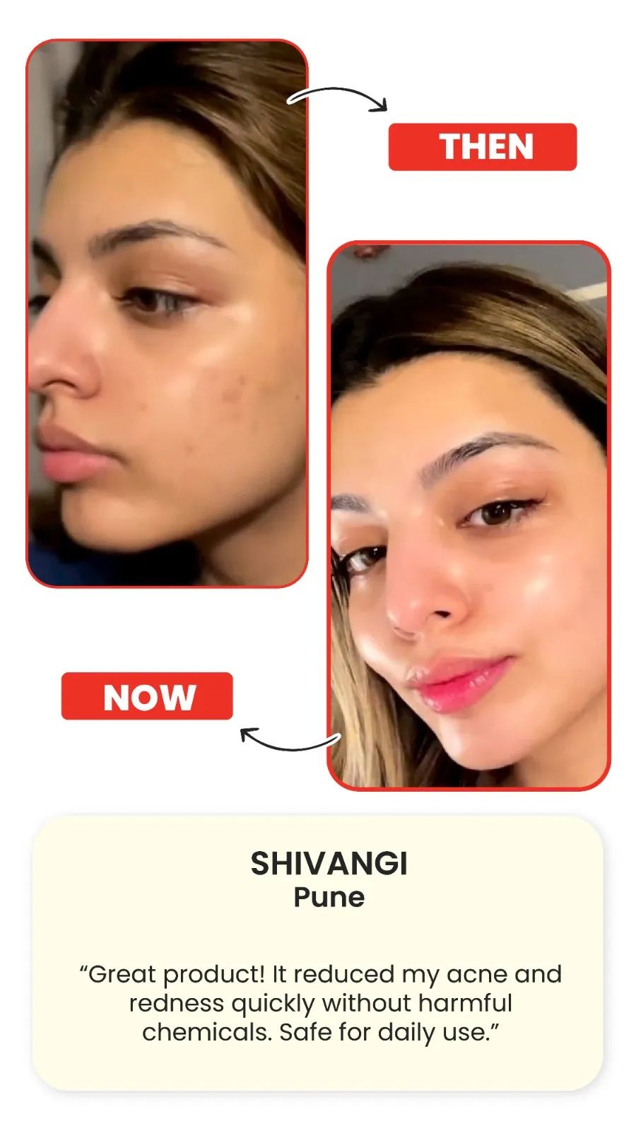 Support for Skin Clarity & Radiance Bright Veda