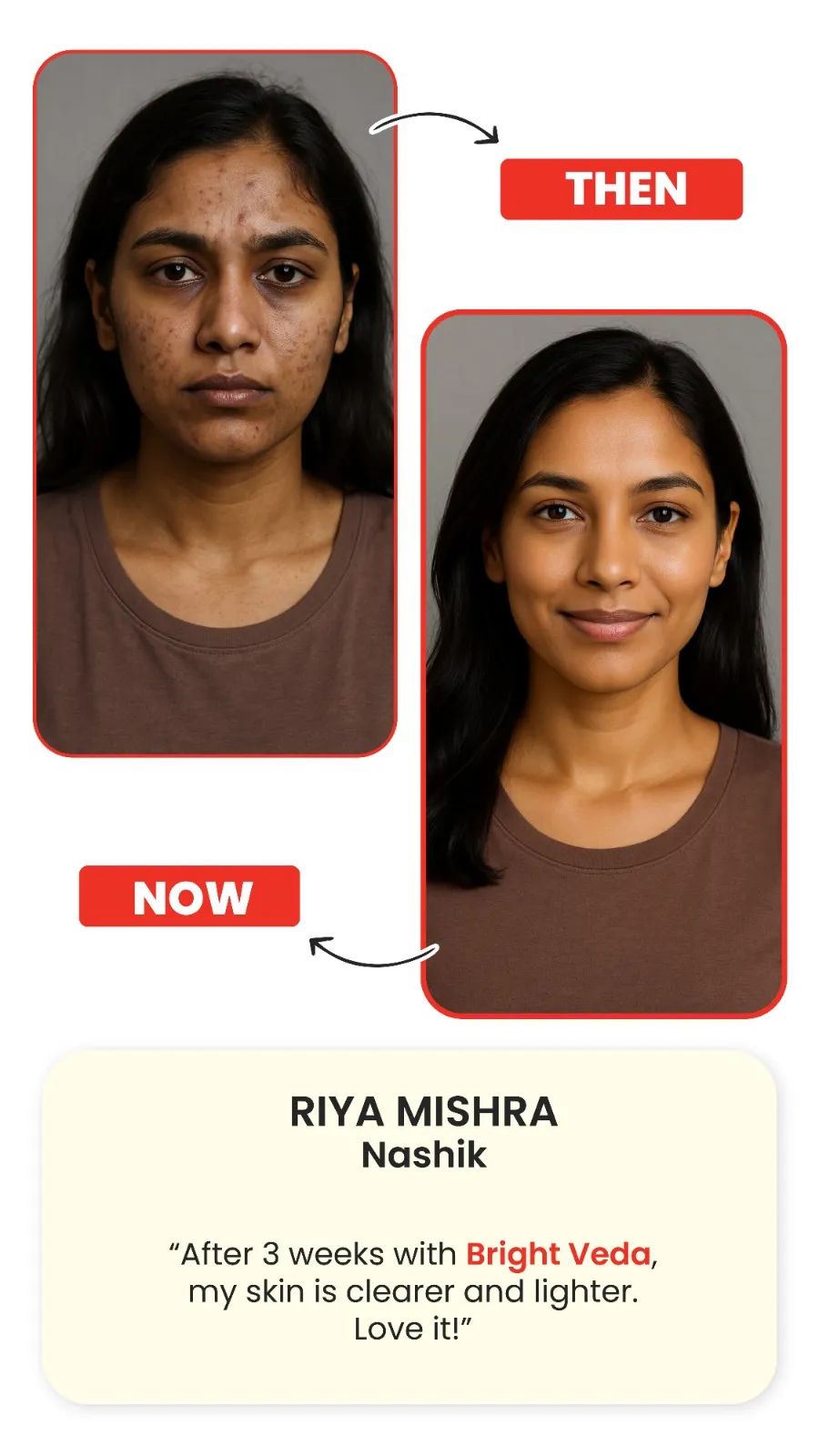 Support for Skin Clarity & Radiance Bright Veda