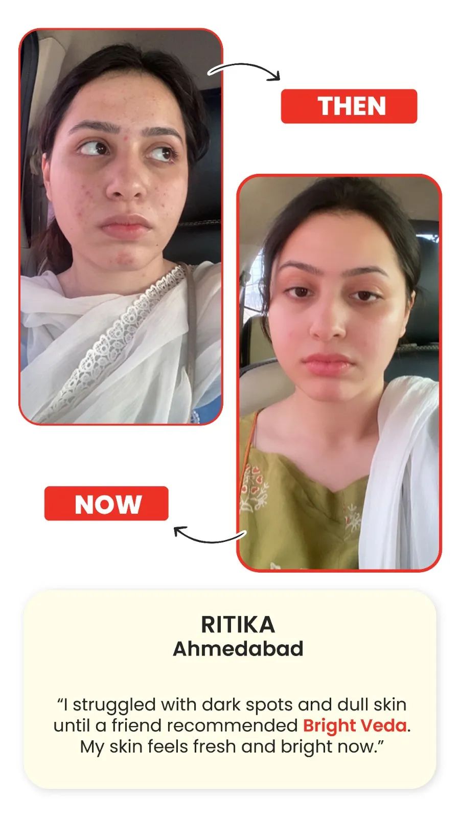 Support for Skin Clarity & Radiance Bright Veda