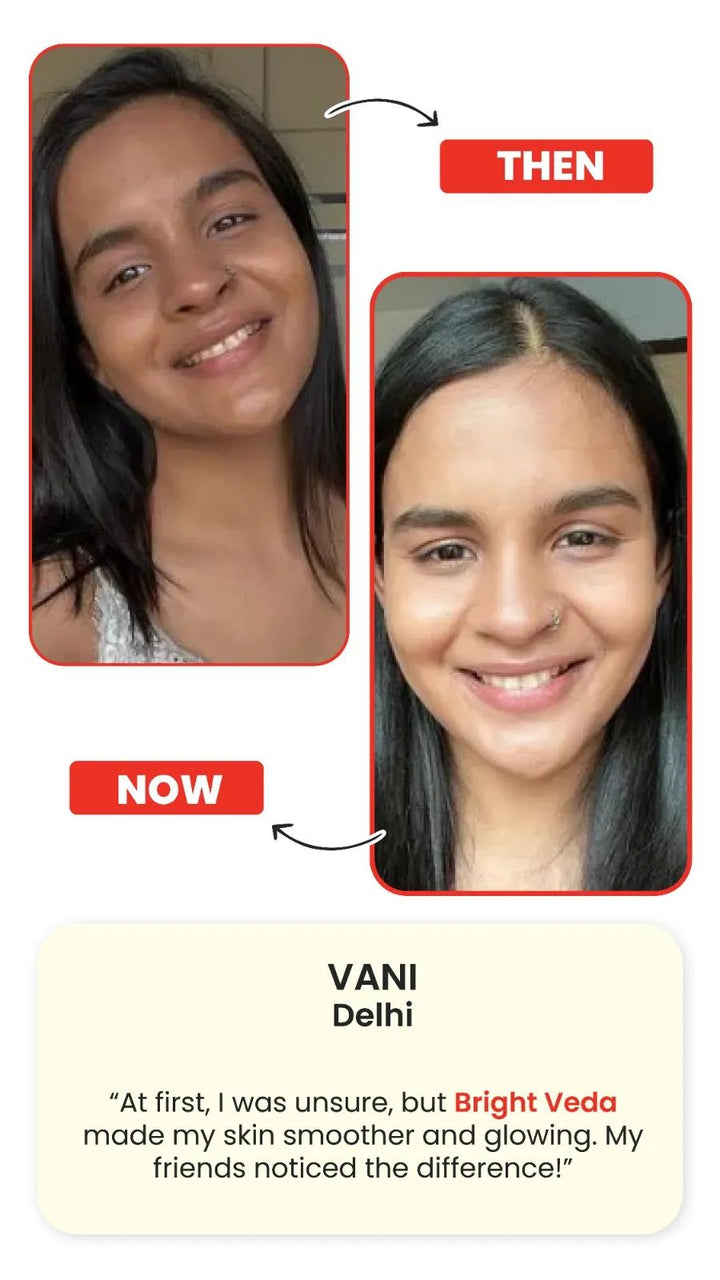 Support for Skin Clarity & Radiance Bright Veda