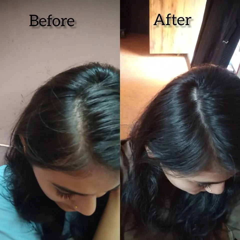 Rosemary Water (100ml) | BUY 1 GET 1 FREE | ⭐️⭐️⭐️⭐️ 4.9/5 Reviews| Rosemary water for hair | Hair Spray for Regrowth | Hair Growth Expert | Hair Growth Serum | Viral Rinse | Bestselling Spray