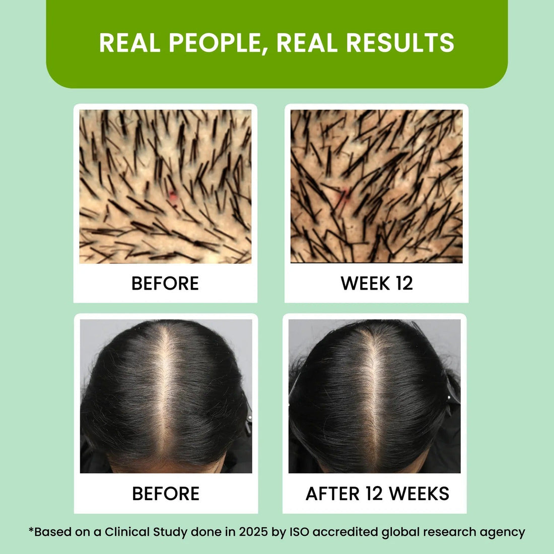 Rosemary Water (100ml) | BUY 1 GET 1 FREE | ⭐️⭐️⭐️⭐️ 4.9/5 Reviews| Rosemary water for hair | Hair Spray for Regrowth | Hair Growth Expert | Hair Growth Serum | Viral Rinse | Bestselling Spray