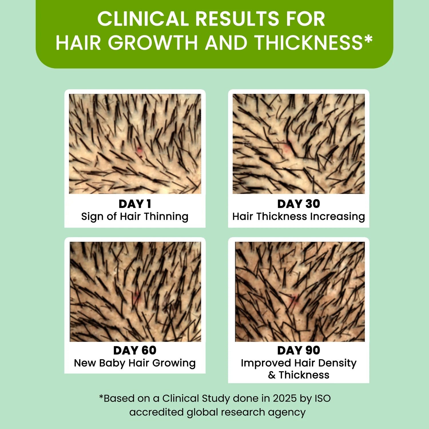 Rosemary Water (100ml) | BUY 1 GET 1 FREE | ⭐️⭐️⭐️⭐️ 4.9/5 Reviews| Rosemary water for hair | Hair Spray for Regrowth | Hair Growth Expert | Hair Growth Serum | Viral Rinse | Bestselling Spray