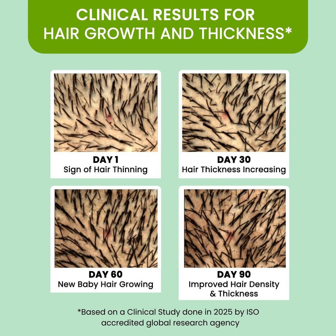 Rosemary Water (100ml) | BUY 1 GET 1 FREE | ⭐️⭐️⭐️⭐️ 4.9/5 Reviews| Rosemary water for hair | Hair Spray for Regrowth | Hair Growth Expert | Hair Growth Serum | Viral Rinse | Bestselling Spray