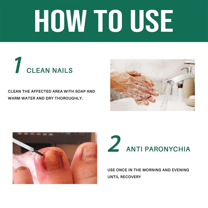 Anti Paronychia Relief Oil ( BUY 1 GET 1 FREE )