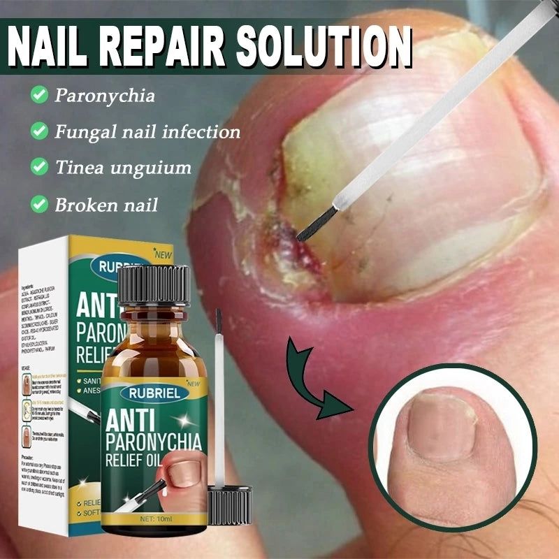 Anti Paronychia Relief Oil ( BUY 1 GET 1 FREE )