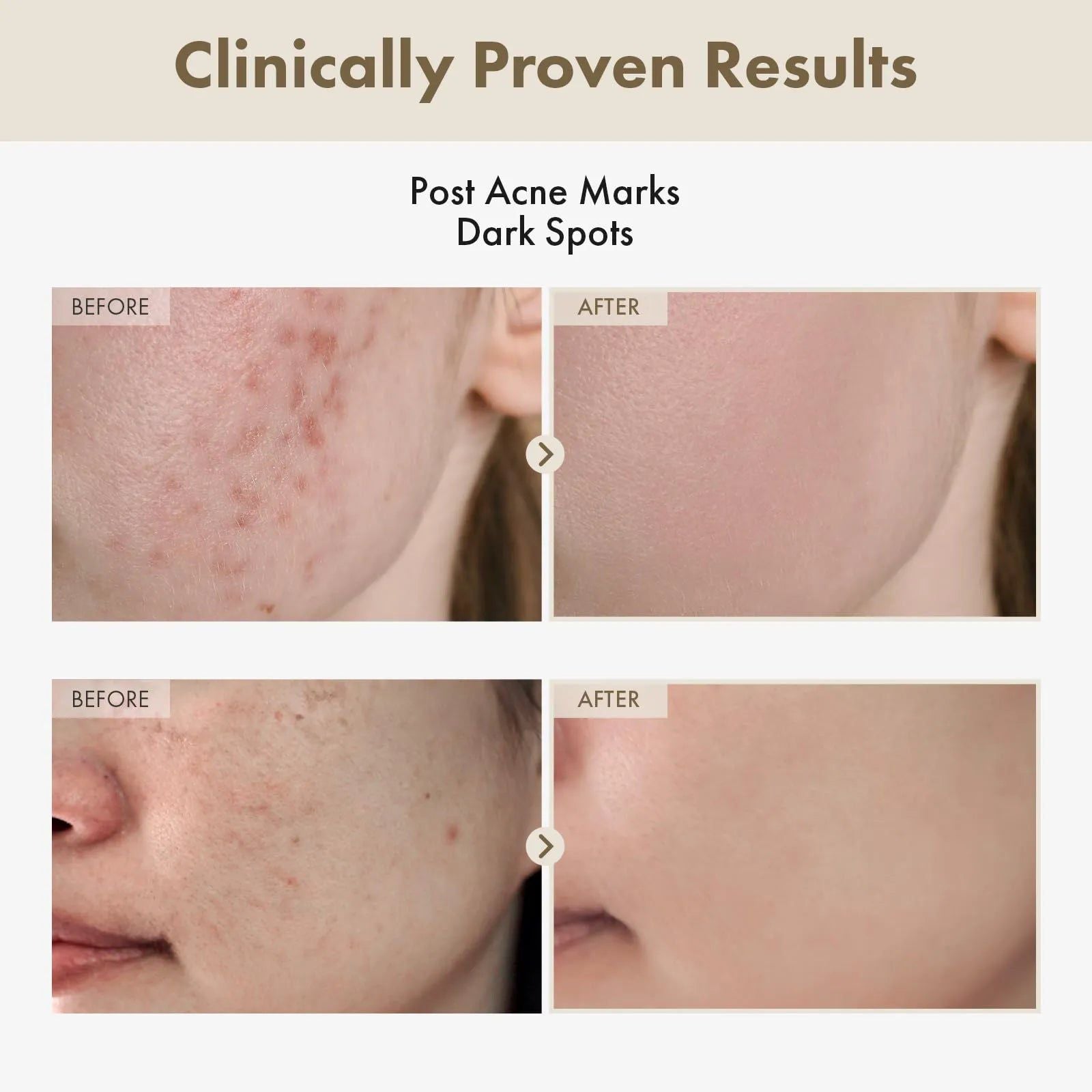 GlowRevive Cream : Arbutin 7% + Tranexamic Acid 4%