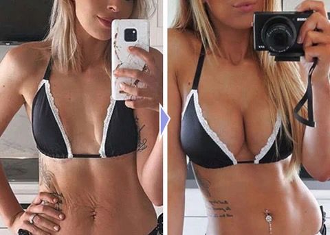 Fivfivgo™ EMS Bust Massager Bra. ( Free Size Auto Adjustment for All Sizes ) Pack of 1