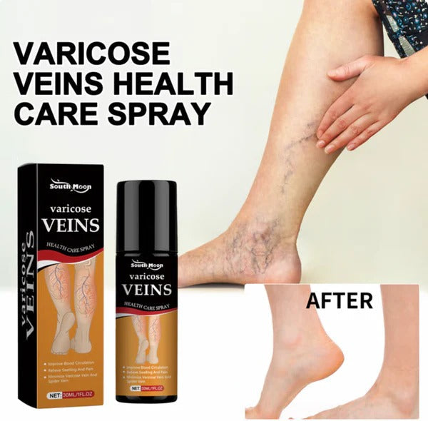 Turmeric Varicose Vein Relief Spray (BUY 1 GET 2 FREE 😍)