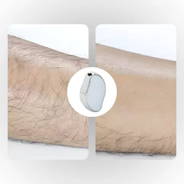 Crystall Hair Eraser for Women and Men, Hair Remover