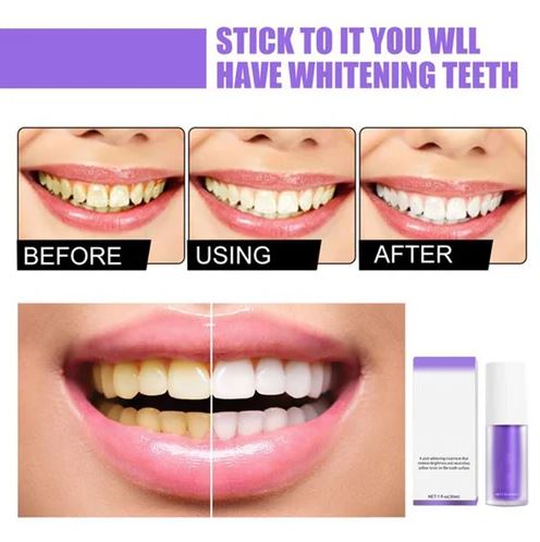 🔥LAST DAY 55% OFF🔥Teeth Colour Corrector Serum