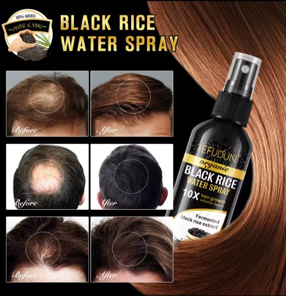 SEFUDUN Organic Black Rice Water for Hair Growth Spray- BUY 1 GET 1 FREE