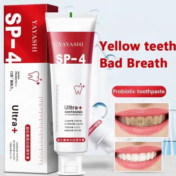 SP 4 Intensive Teeth Whitening Toothpaste ( BUY 1 GET 1 FREE ) ⭐️⭐️⭐️⭐️ 4.9/5 Reviews