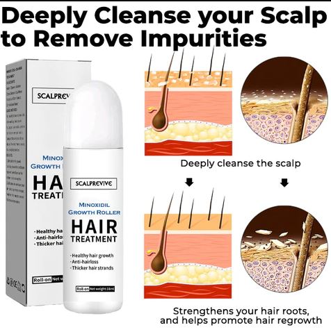 Fivfivgo™ ScalpRevive Minoxidil Growth Roller-( BUY 1 GET 1 FREE )