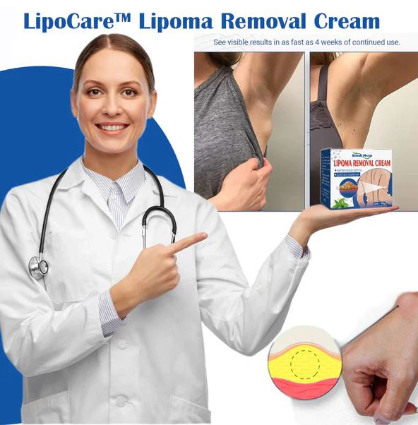 LipoCare™ | Doctor's No 1 choice | Lipoma Removal Cream 🩺- ( BUY 1 GET 1 FREE )⭐️⭐️⭐️⭐️ 4.9/5 Reviews